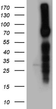 Polyclonal Rabbit anti-Human SCNN1A / ENaC Alpha Antibody (WB)