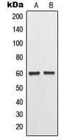 MMP11 Antibody (Internal)