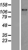 Human DHX8 Protein (Over-Expression Lysate Myc-DDK (Flag))