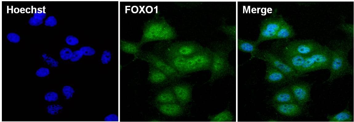 FOXO1 / FKHR Antibody (clone 3B6)