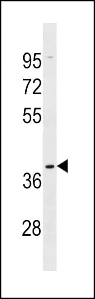Polyclonal Rabbit anti-Human OR5AK2 Antibody (aa280-307, WB)