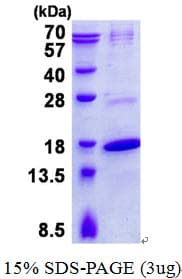 Human TRAPPC2 / SEDL Protein (Recombinant His)