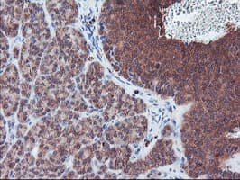 PECR Antibody (clone OTI1F2)