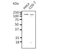 IHC-plus™ Polyclonal Goat anti-Human CDH1 / E Cadherin Antibody (IHC, WB)