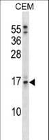 USAG1 / SOSTDC1 Antibody (aa169-196)