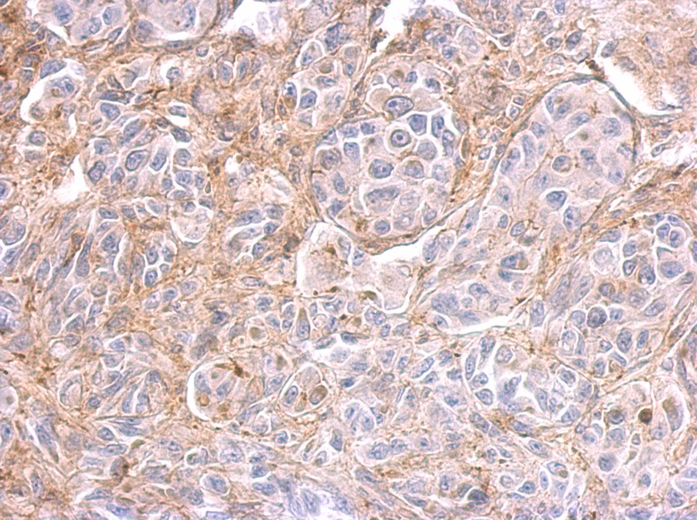 PPFIBP2 Antibody (aa120-392)