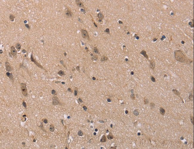 FAM107A / TU3A Antibody