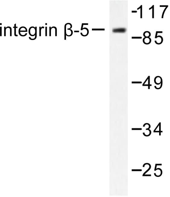 ITGB5 / Integrin Beta 5 Antibody (Val746)