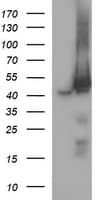 Monoclonal Mouse anti-Human MAP2K1 / MKK1 / MEK1 Antibody (clone OTI9E9, IHC, IF, WB)
