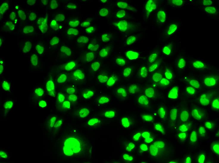 Polyclonal Rabbit anti-Human NAMPT / Visfatin Antibody (IHC, IF, WB)