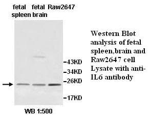 IL6 / Interleukin 6 Antibody (aa30-212)