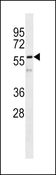 Vimentin Antibody
