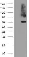 Monoclonal Mouse anti-Human PKLR Antibody (clone OTI1G9, WB)