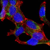 AMACR / P504S Antibody (clone 2A10F3)