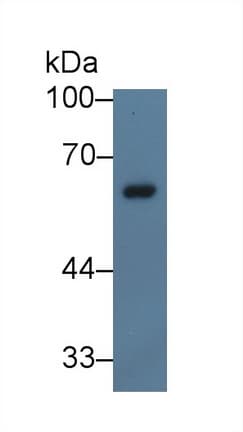 NCF2 / NOXA2 / p67phox Antibody (aa355-526)