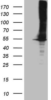 ASS1 / ASS Antibody (C-Terminus, clone OTI14C1)