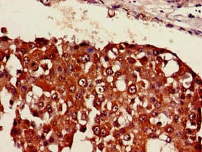 PA26 / SESN1 Antibody (aa224-337)