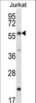FOXJ3 Antibody (aa148-176)