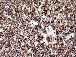 ACY3 Antibody (clone OTI4C1)