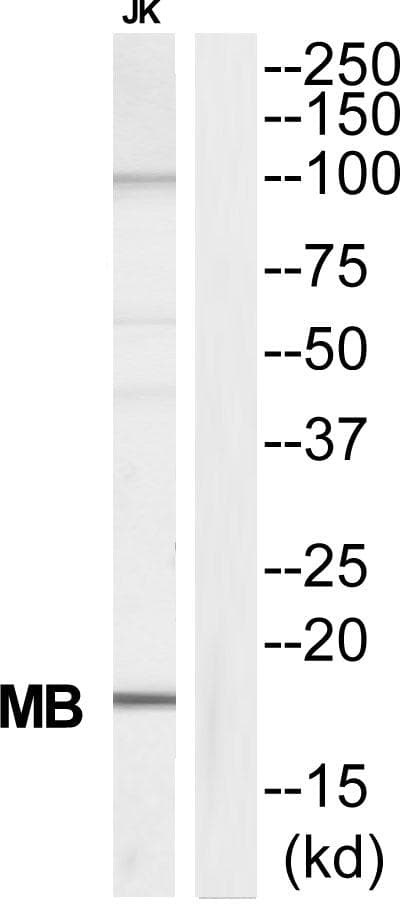 MB / Myoglobin Antibody