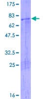 Human ATAD2 Protein (Recombinant GST)