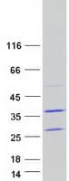 Human TATDN1 Protein (Recombinant Myc-DDK (Flag))