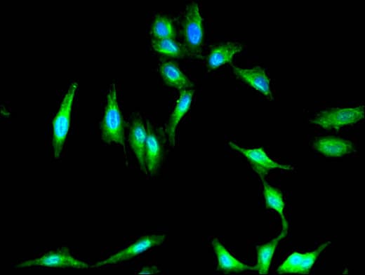 Polyclonal Rabbit anti-Human Fibrocystin / PKHD1 Antibody (IF)