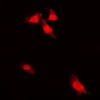 G3BP1 / G3BP Antibody (phospho-Ser232)