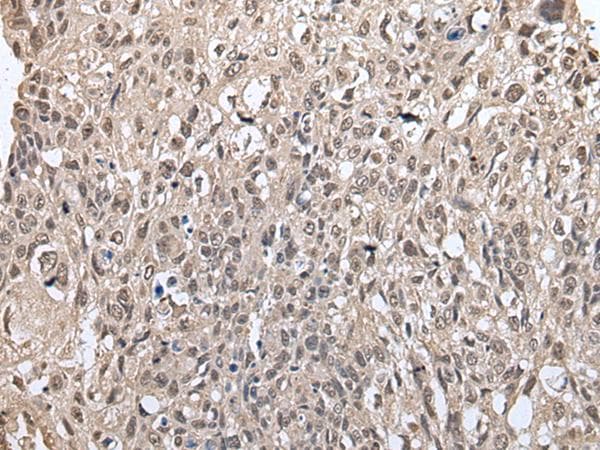 MAP1D Antibody