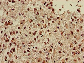 NGFR / CD271 / TNR16 Antibody