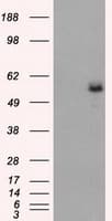 IHC-plus™ FH / Fumarase / MCL Antibody (clone 9G4)