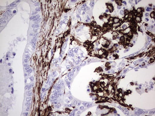 Monoclonal Mouse anti-Human Vimentin Antibody (clone UMAB160, IHC, IF, WB)