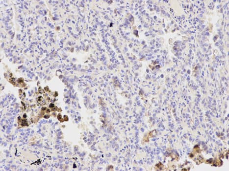 IHC-plus™ Polyclonal Rabbit anti-Human PPP1CB Antibody (IHC, IF, WB)
