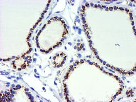 GOLM1 / GP73 / GOLPH2 Antibody (clone OTI5F4)