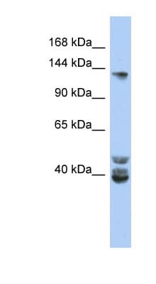 NCOA1 / SRC-1 Antibody (aa611-660)
