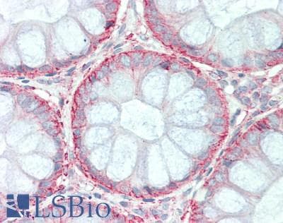 IHC-plus™ SLC1A4 / ASCT1 Antibody
