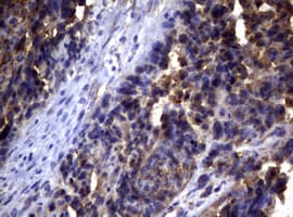 PIK3C2A Antibody (aa230-560, clone OTI4E6)