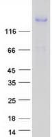 Human CORIN Protein (Recombinant Myc-DDK (Flag))