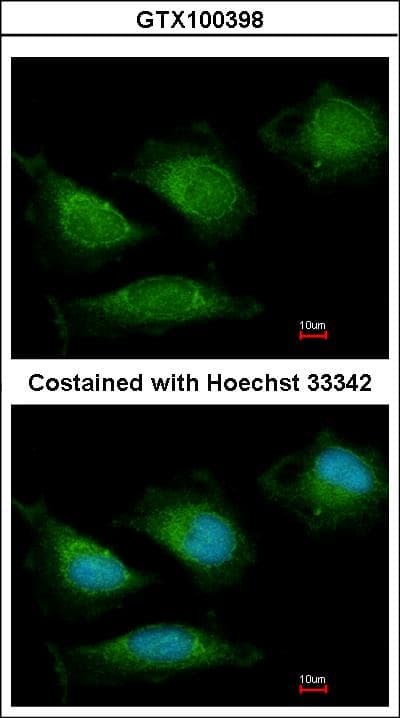 IHC-plus™ Polyclonal Rabbit anti-Human POLG Antibody (IHC, IF, WB)