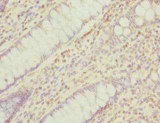 Polyclonal Rabbit anti-Human PPM1A / PP2CA Antibody (IHC, WB)
