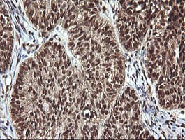 FAK / Focal Adhesion Kinase Antibody (clone OTI4D11)