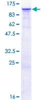 Human FGD3 Protein (Recombinant GST)