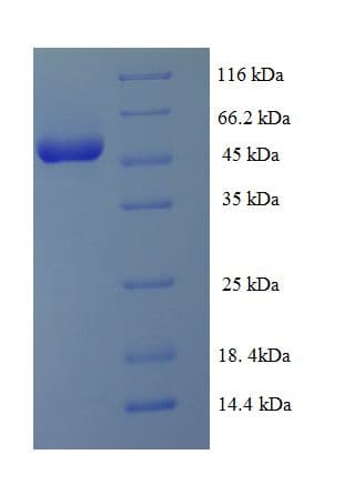 Human ATG3 Protein (Recombinant His-SUMO)