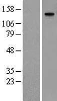MMRN1 Protein (Over-Expression Lysate Myc-DDK (Flag))
