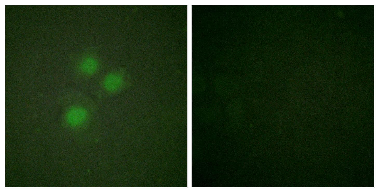 Polyclonal Rabbit anti-Human NIFK / MKI67IP Antibody (Ab-234, IHC, IF)