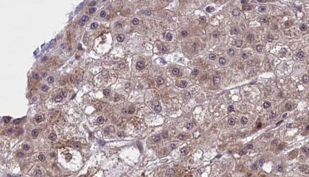 SLC22A8 / OAT3 Antibody