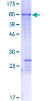 Human NOSTRIN Protein (Recombinant GST)