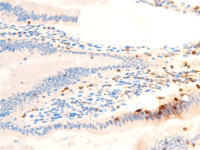 Polyclonal Rabbit anti-Human SYK Antibody (phospho-Tyr323, IHC, IF, WB)