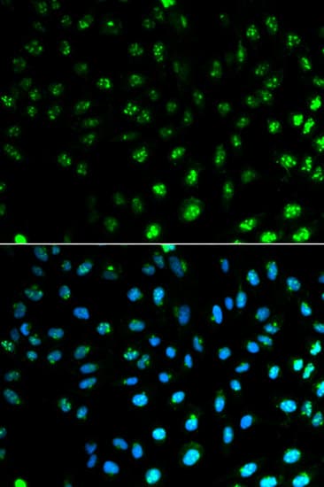 S100A8 / MRP8 Antibody