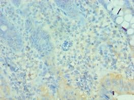 Polyclonal Rabbit anti-Human MTM1 / Myotubularin Antibody (aa484-603, IHC, WB)
